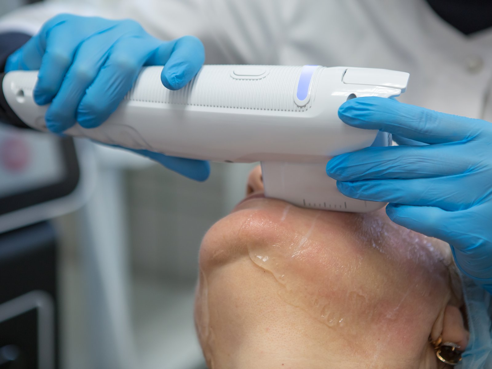 Advanced laser skin treatment